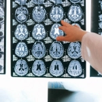 Медицинская диаграма влияния азартных игр на мозговую активность